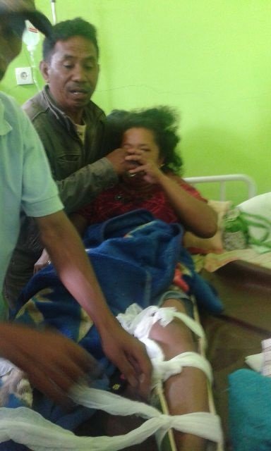Ibu hamil yang mengalami patah tulang. (Foto: Ferdinand Ambo/Floresa)